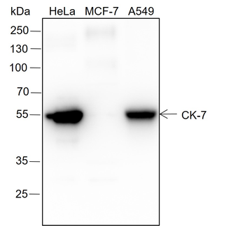 CK-7 Recombinant Rabbit Monoclonal Antibody