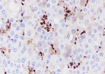 HBA1 Recombinant Rabbit Monoclonal Antibody