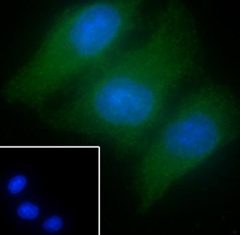 Aurora B Recombinant Rabbit Monoclonal Antibody
