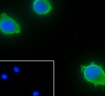 BMP6 Recombinant Rabbit Monoclonal Antibody
