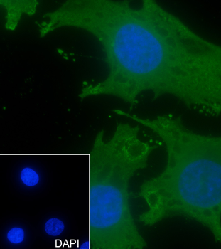 Alpha Actinin 4 Recombinant Rabbit Monoclonal Antibody