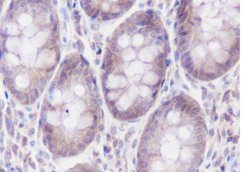 Alpha Actinin 4 Recombinant Rabbit Monoclonal Antibody