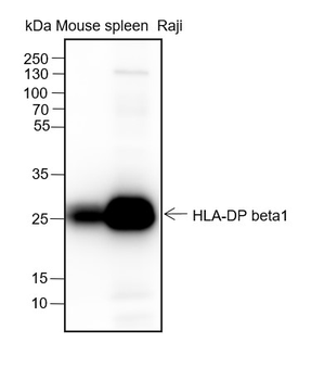 HLA-DPB1 Recombinant Rabbit Monoclonal Antibody