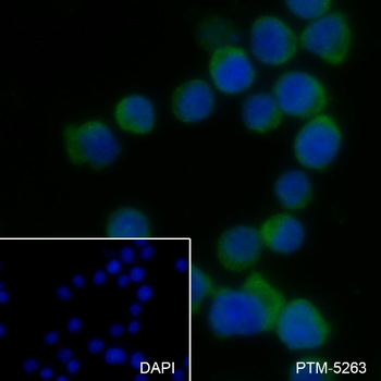HLA-DPB1 Recombinant Rabbit Monoclonal Antibody