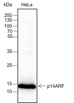 CDKN2A/p14ARF Recombinant Rabbit Monoclonal Antibody