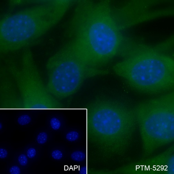 PDPK1 Recombinant Rabbit Monoclonal Antibody