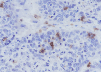ITGAE/CD103 Recombinant Rabbit Monoclonal Antibody