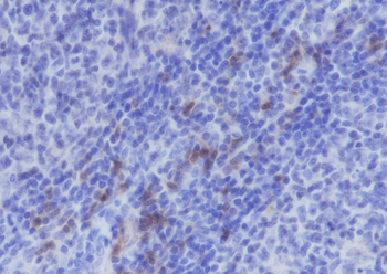 ITGAE/CD103 Recombinant Rabbit Monoclonal Antibody
