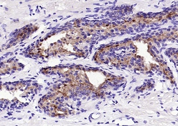 Prostate Specific Antigen antibody