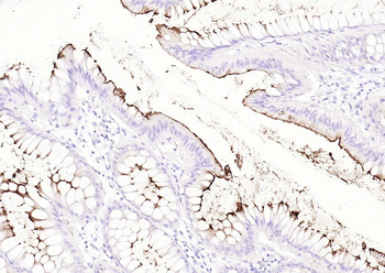 CD66a Recombinant Rabbit Monoclonal Antibody