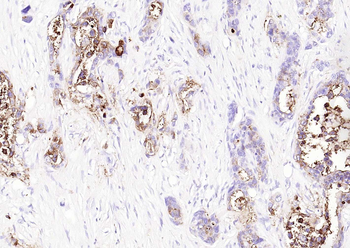 CD66a Recombinant Rabbit Monoclonal Antibody