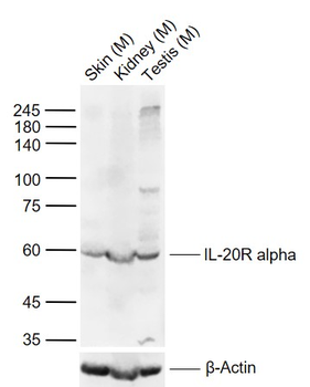 IL-20R alpha Rabbit Polyclonal Antibody