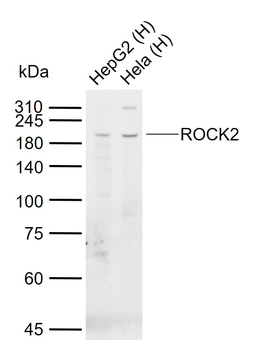 ROCK2 Mouse Monoclonal Antibody