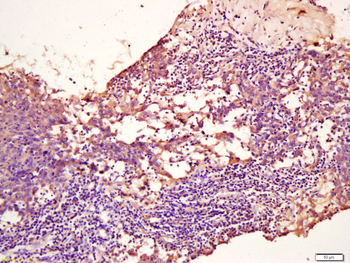 TPM2 Rabbit Polyclonal Antibody