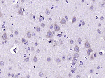CH25H Rabbit Polyclonal Antibody