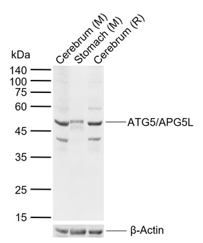 ATG5/APG5L antibody