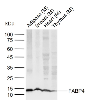FABP4 Recombinant Rabbit Monoclonal Antibody