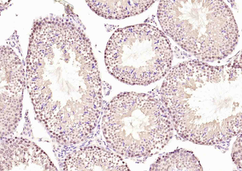 HDAC7 Rabbit Polyclonal Antibody