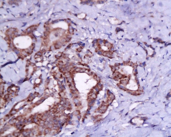 TSHR (CT) Rabbit Polyclonal Antibody