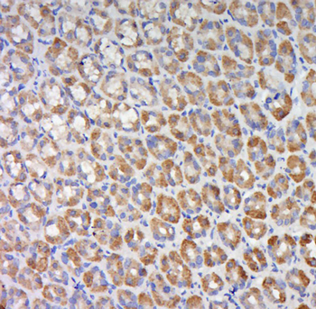 C11ORF77 Rabbit Polyclonal Antibody