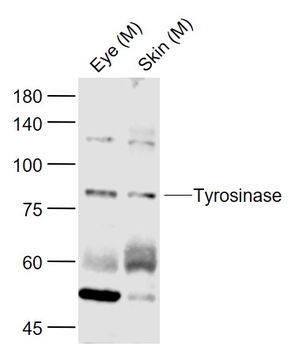Tyrosinase Rabbit Polyclonal Antibody