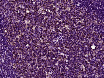 Galectin 9 Rabbit Polyclonal Antibody