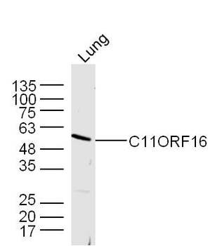 C11ORF16 Rabbit Polyclonal Antibody