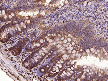 VEGF-C Rabbit Polyclonal Antibody