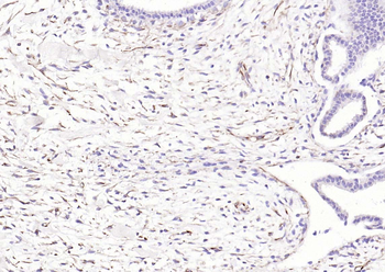 Vimentin Rabbit Polyclonal Antibody