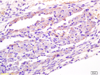 Wnt1 Rabbit Polyclonal Antibody