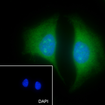 ELP3 Recombinant Rabbit Monoclonal Antibody