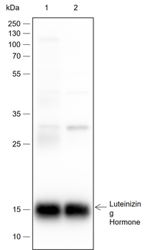 LHB Recombinant Rabbit Monoclonal Antibody