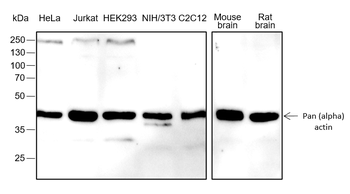 Pan Actin Recombinant Rabbit Monoclonal Antibody