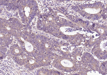 P4HB Recombinant Mouse Monoclonal Antibody