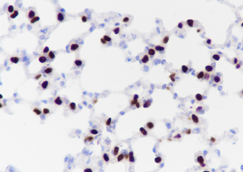 TTF1/NKX2-1 Recombinant Rabbit Monoclonal Antibody