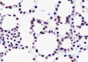TTF1/NKX2-1 Recombinant Rabbit Monoclonal Antibody