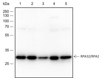 RPA2 Recombinant Rabbit Monoclonal Antibody