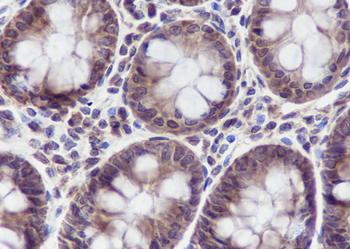 STRAP Recombinant Mouse Monoclonal Antibody