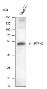 PTPN2 Recombinant Mouse Monoclonal Antibody