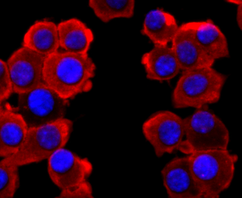 VAMP2 Recombinant Rabbit Monoclonal Antibody