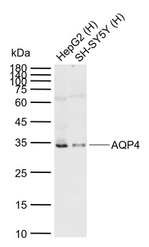 AQP4 antibody