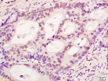 Phospho-LEF1 (Ser42) Rabbit Polyclonal Antibody