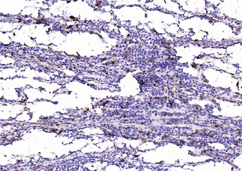 CD68 Mouse Monoclonal Antibody