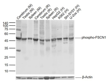 phospho-FSCN1 (Ser39) antibody