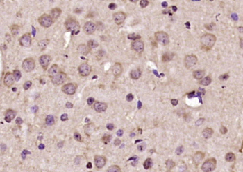 HCF2 Rabbit Polyclonal Antibody