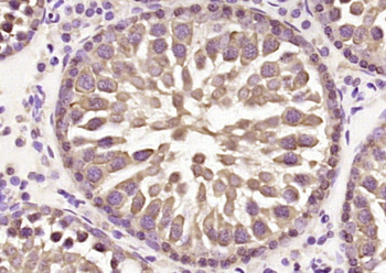 HCF2 Rabbit Polyclonal Antibody