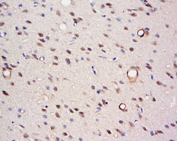 TFCP2C Rabbit Polyclonal Antibody