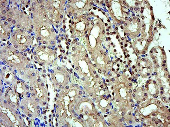 IRX5 Rabbit Polyclonal Antibody