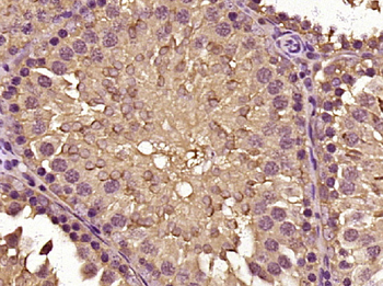 ASB7 Rabbit Polyclonal Antibody