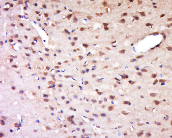 ASB7 Rabbit Polyclonal Antibody